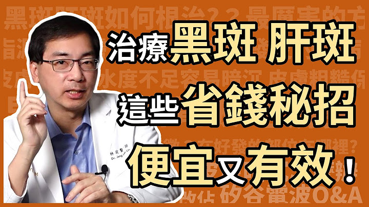 治療黑斑、肝斑，有哪些省錢又有效，高CP值的方法？醫美里長林政賢醫師大揭密！ - 天天要聞