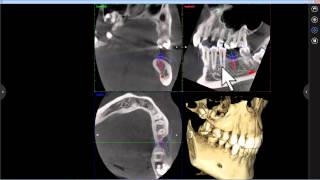 New mRomexis for light image viewing in Planmeca Romexis 4.0