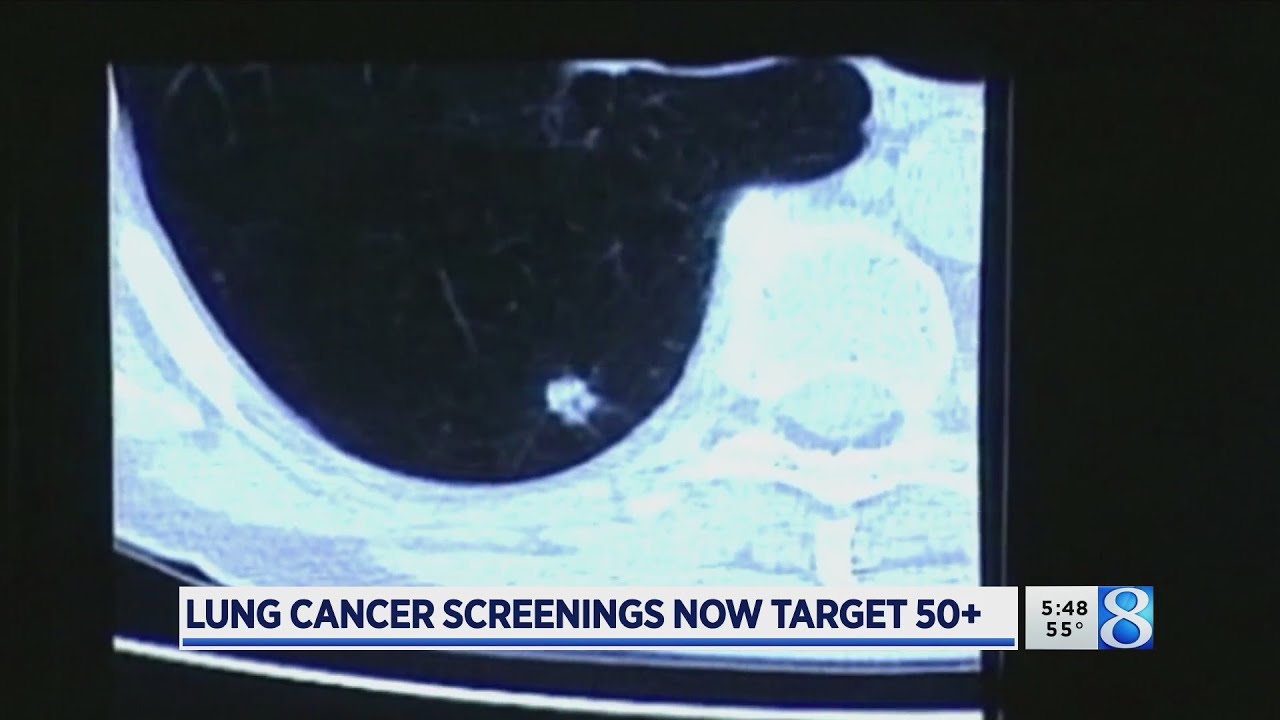 Guidelines Smokers should start lung cancer screenings younger YouTube