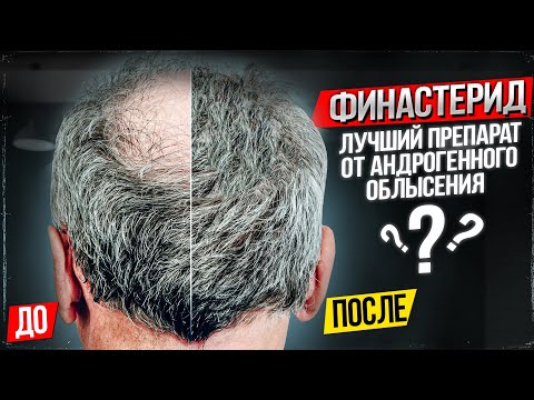 Видео: Вызывает ли финастерид депрессию?