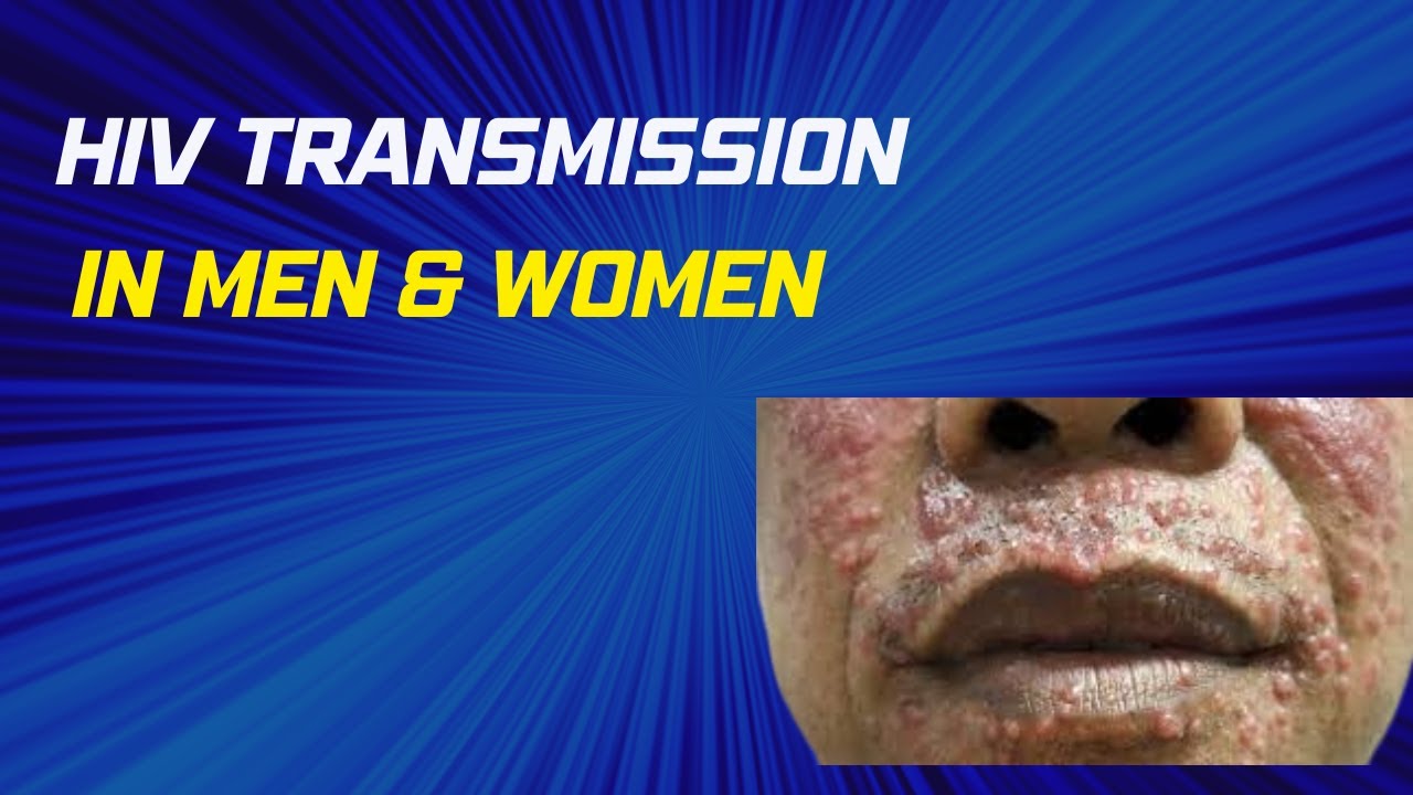 HIV transmission through a small cut ( best hiv test ) YouTube