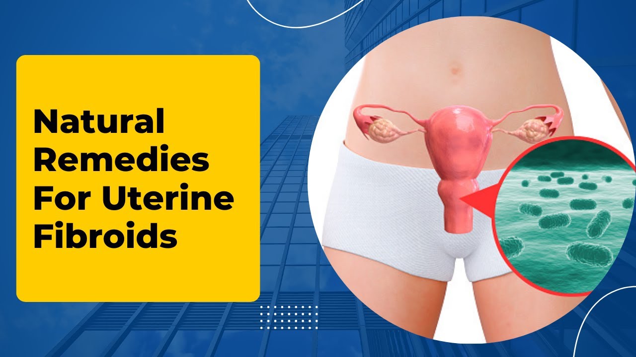 Natural Remedies For Uterine Fibroids YouTube