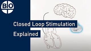 Revolutionizing Cardiac Care: BIOTRONIK's Closed Loop Stimulation Explained