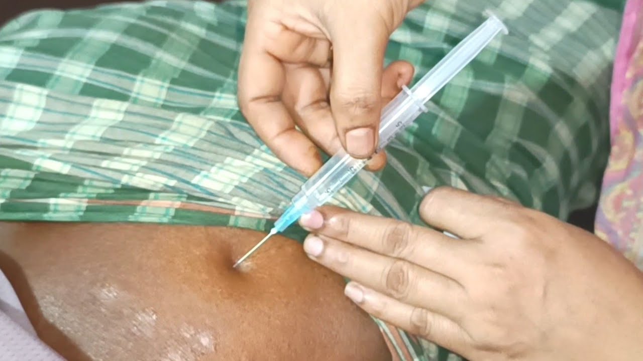 Must Watch New Buttock Injection Ketorolac injection push Ketonic EP 25 ...