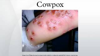 Cowpox
