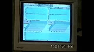 Needle Tp Emg By Hubbard And Gevirtz 1995