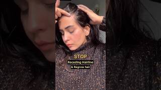 ?‍♂️?Can Receding Hairline Regrow?  nonsponsored recedinghairline homeremedies