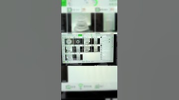 ✨𝟭𝟬 𝗖𝗮𝗺𝗲𝗿𝗮𝘀 𝗘𝘆𝗲 𝗗𝗿𝗼𝗽 𝗕𝗼𝘁𝘁𝗹𝗲𝘀 𝗜𝗻𝗹𝗶𝗻𝗲 𝗜𝗻𝘀𝗽𝗲𝗰𝘁𝗶𝗼𝗻 𝗦𝗼𝗹𝘂𝘁𝗶𝗼𝗻🔍𝗞𝗲𝘆𝗲 𝗔𝗜 𝗩𝗶𝘀𝗶𝗼𝗻