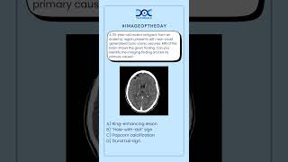 👉Can you identify the imaging finding and list its primary cause?