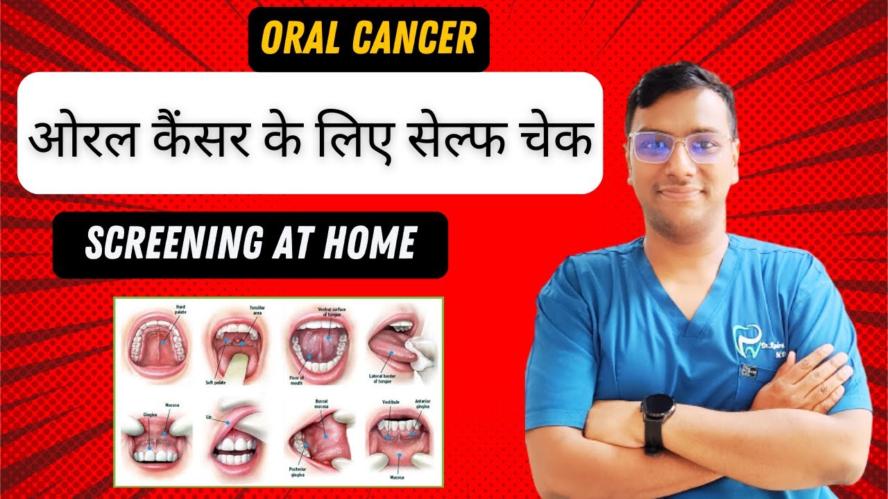 Dr Rudra Mohan |मुख कैंसर के लिए आत्म मौखिक जांच करें | MOUTH SELF SCREENING FOR ORAL CANCER AT HOME