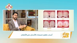 أسباب تغير لون الأسنان وظهور تصبغات صفراء عند الأطفال | برنامج صباح النور