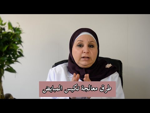 ٤٧_ علاج  متلازمة تكيس المبايض بالأعشاب الطبيعية