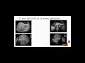 ISPD Virtual Education Series - Abdominal Wall Defects