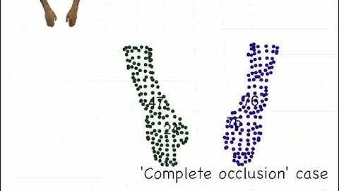 Multiple Object Tracking Using an RGB-D Camera by Hierarchical Spatiotemporal Data Association