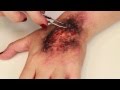 FX Makeup Series Third Degree Fire Burn
