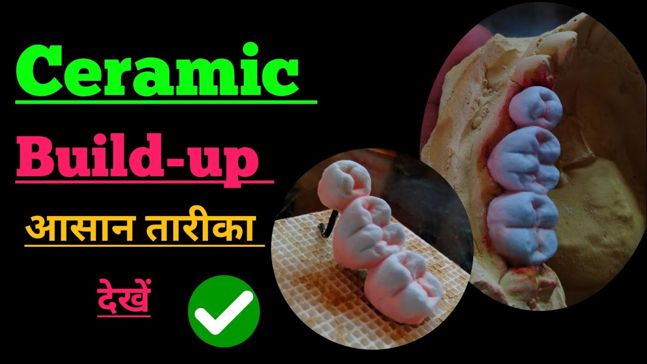 Ceramic build up Technique How to build up ceramic Laboratory