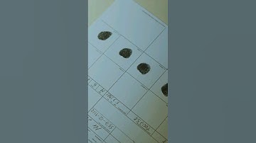 Exploring Human Blood Vessel and Fingerprint Patterns - No Two Alike!😱 #facts #viral