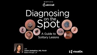 Diagnosing on the Spot: A Guide to Solitary Lesions screenshot 2
