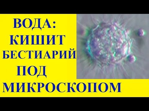 Видео: Является ли кодиеум одноклеточным организмом?