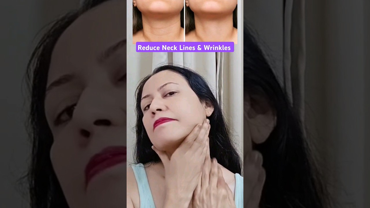 Remove Neck Lines & Wrinkles 