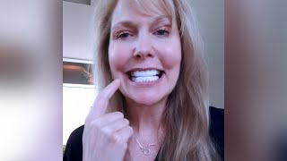 Honest review of Pop On Veneers