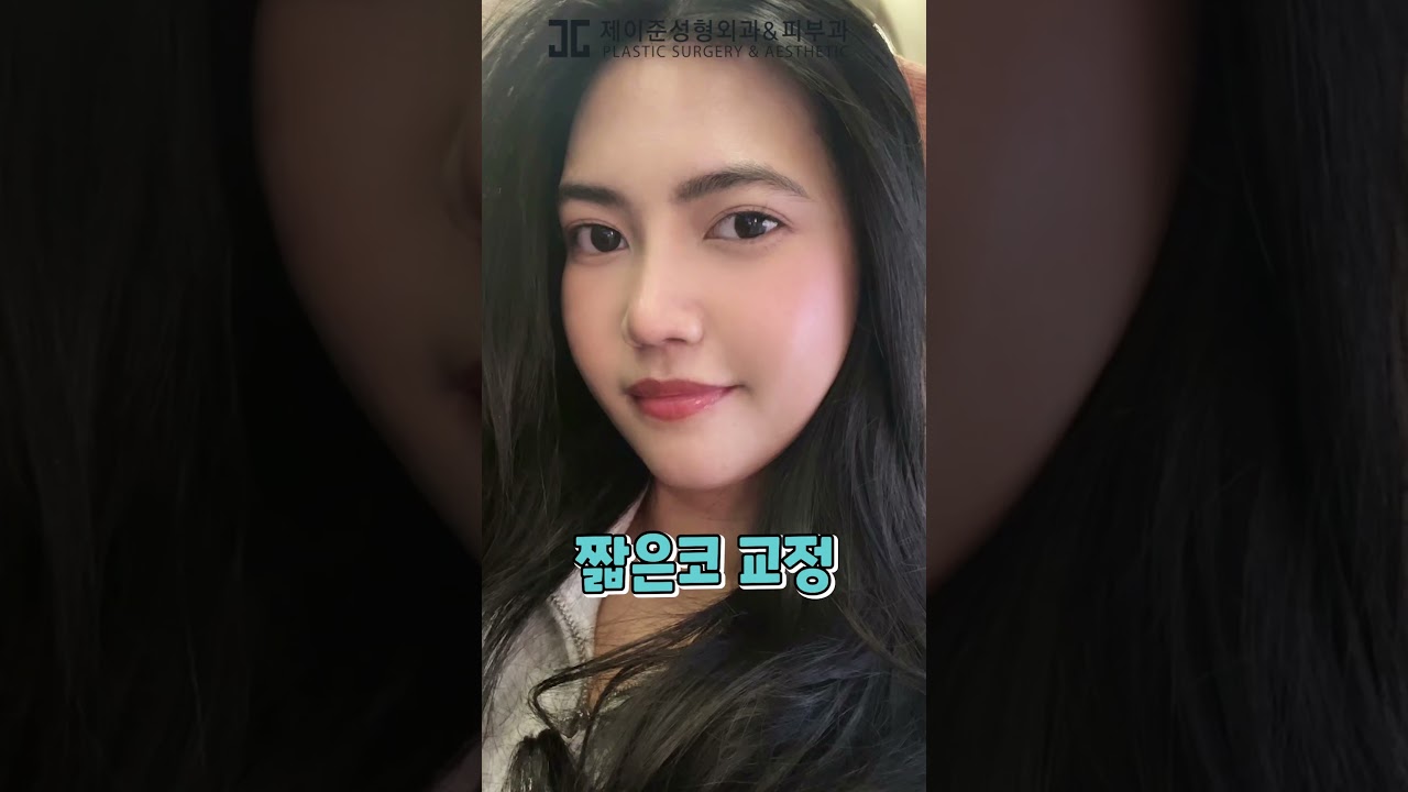 [Thẩm mỹ viện da liễu Jayjun] Bạn đã phẫu thuật gì? ✨So sánh trước sau✨ #shorts