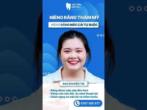 Khách hàng trước và sau khi niềng răng mắc cài tại Nha khoa VIệt Hàn Nha Trang #niengrangnhatrang