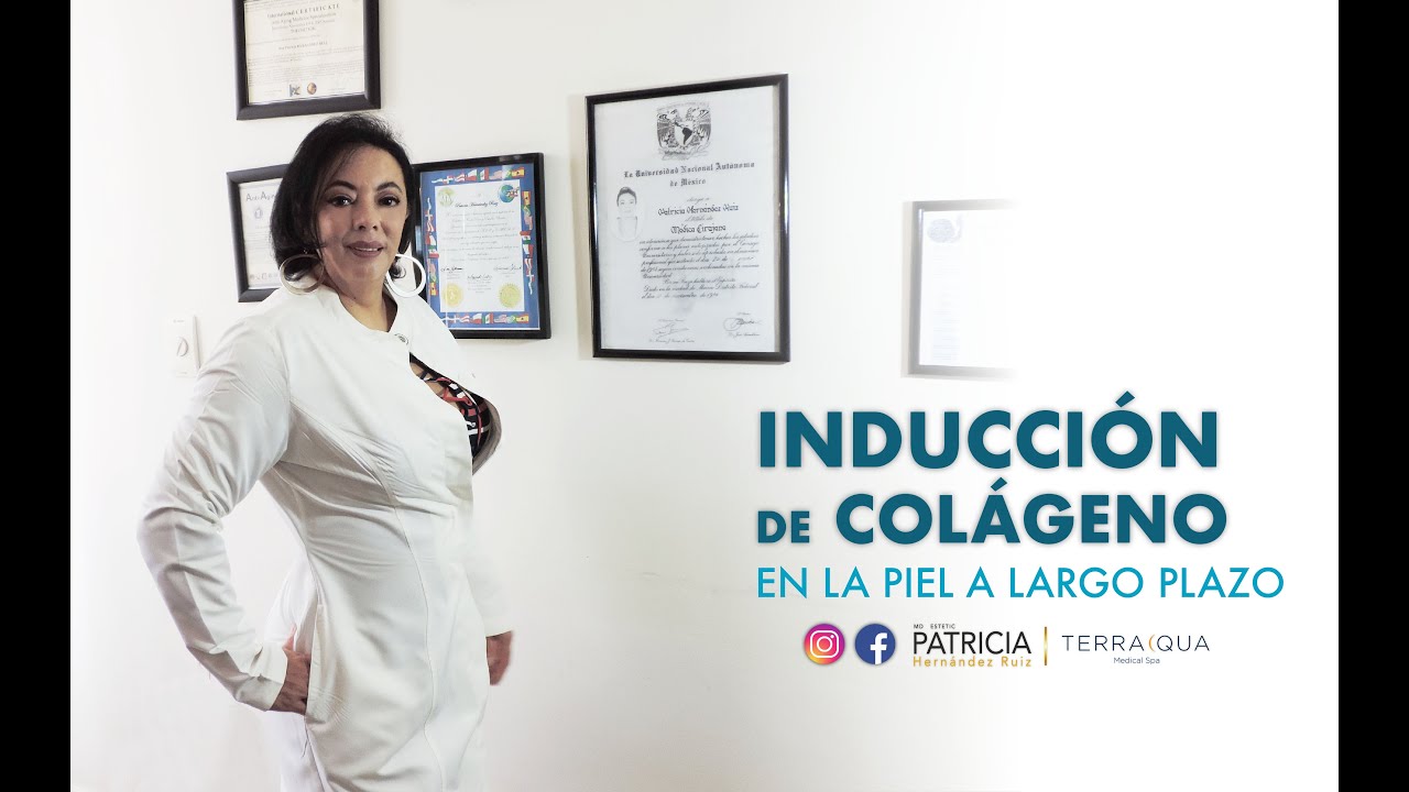 Inducción de Colágeno con Radiofrecuencia y HIFU