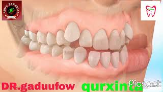 Qurxin Deenka Iyo Toosin Isqurxi Oo Kadhig Afkaaga Iyo Ilkahaaga