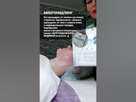 РЕЗУЛЬТАТ 🔥 УЖЕ ПОСЛЕ ПЕРВОЙ ПРОЦЕДУРЫ! ДЕРМАПЕН/МИКРОНИДЛИНГ # ...