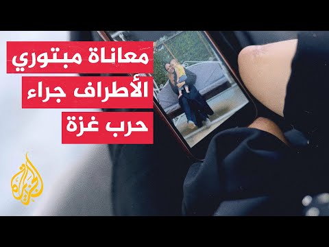 معاناة يومية لمبتوري الأطراف جراء القصف الإسرائيلي على قطاع غزة
