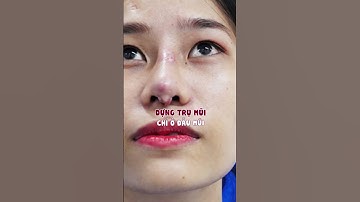 Tháo sụn mũi có trở về dáng bình thường không | Bác sĩ Trọng #shorts
