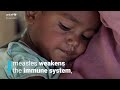 Measles cases have spiked in 2022
