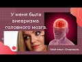 ПРЯМОЙ ЭФИР - У МЕНЯ БЫЛА АНЕВРИЗМА ГОЛОВНОГО МОЗГА. МОЙ ОПЫТ