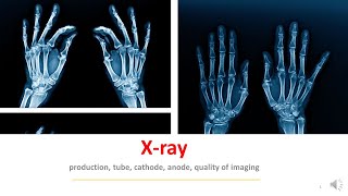 نيوكليون | X-rays  الأشعة السينية الجزء الأول