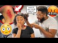 HICKEY PRANK ON MY DAD (HE WAS ANGRY!)