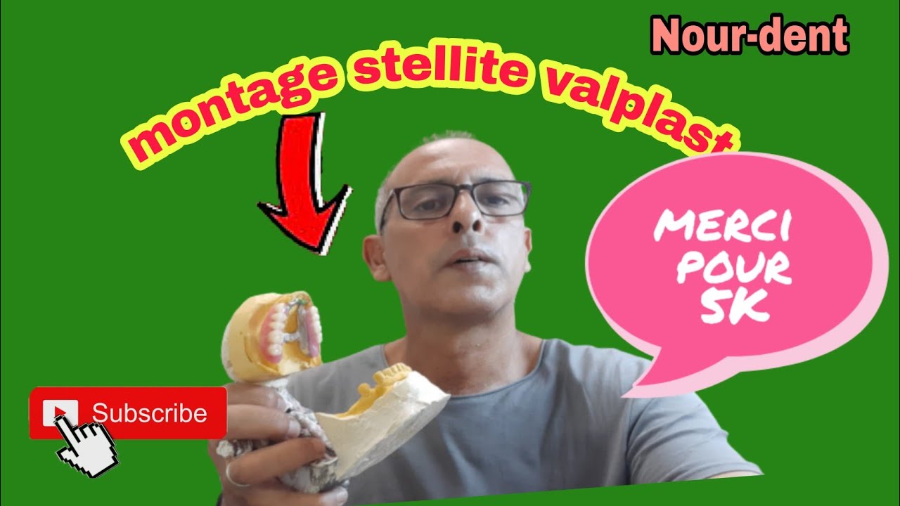 Montage stellite métallique dentaire valplast. @NoureddineVlogsBr