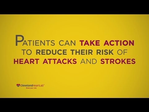 Know Your Risk Video™ from Cleveland HeartLab