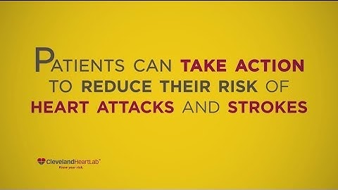 Know Your Risk Video™ from Cleveland HeartLab