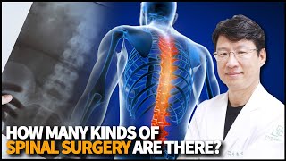 How many kinds of Spinal Disease and Surgery are there? How do we diagnose them?