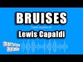 Lewis Capaldi - Bruises (Karaoke Version)