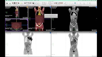 FusionSync Tutorial - Part 03: Region of Interest Fusion Method
