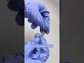 Zealmax Ortho Foot and Ankle Implants