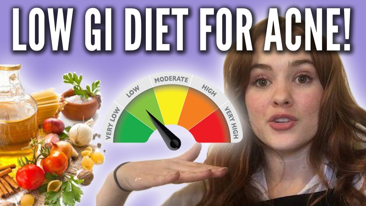 How I Cured my Acne: Low Glycemic Diet - YouTube