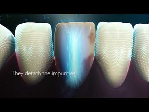 Silk'n ToothWave   The First DentalRF Electric Toothbrush