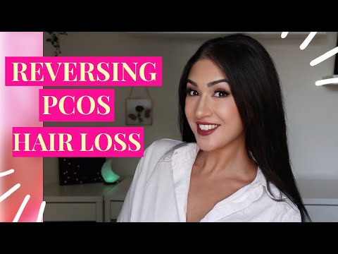 Reversing PCOS Hair Loss