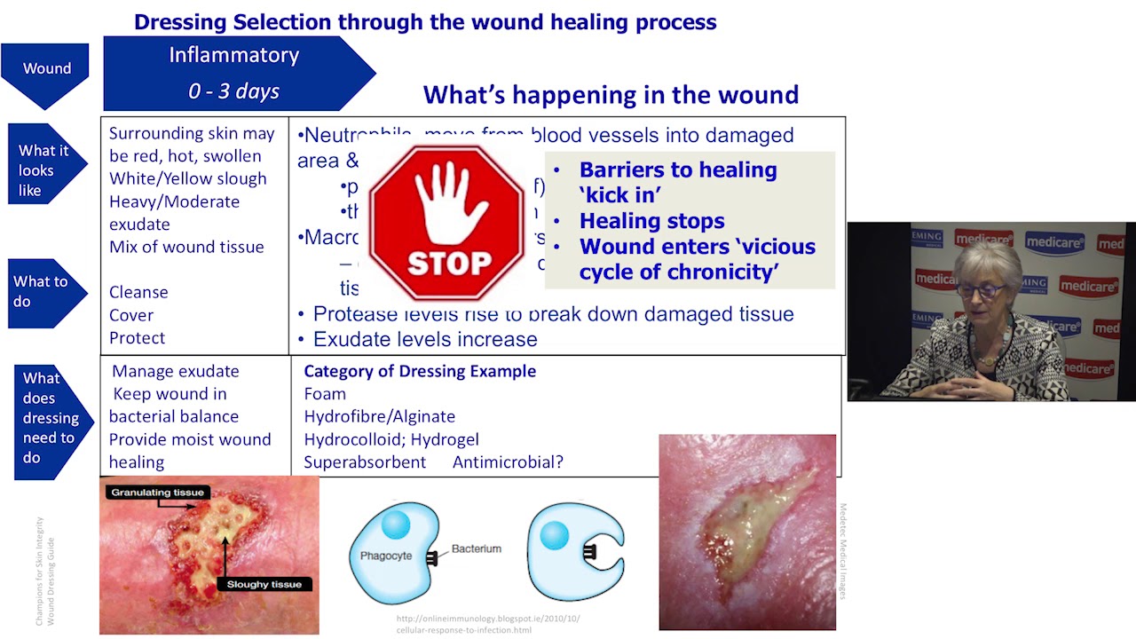 Types Of Wound Dressings