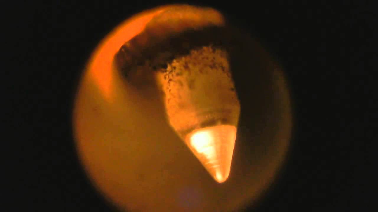 Microscope Video 5 Checking Record Player Needles YouTube