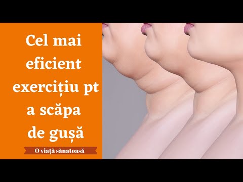 Video: Femeile Au Dezvăluit Secretele De A Scăpa De O Bărbie Dublă Fără Intervenție Chirurgicală