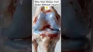 Joint Pain? Here's How It Starts &amp; Prevention #arthritis#osteoarthritis#jointhealth#viralshorts